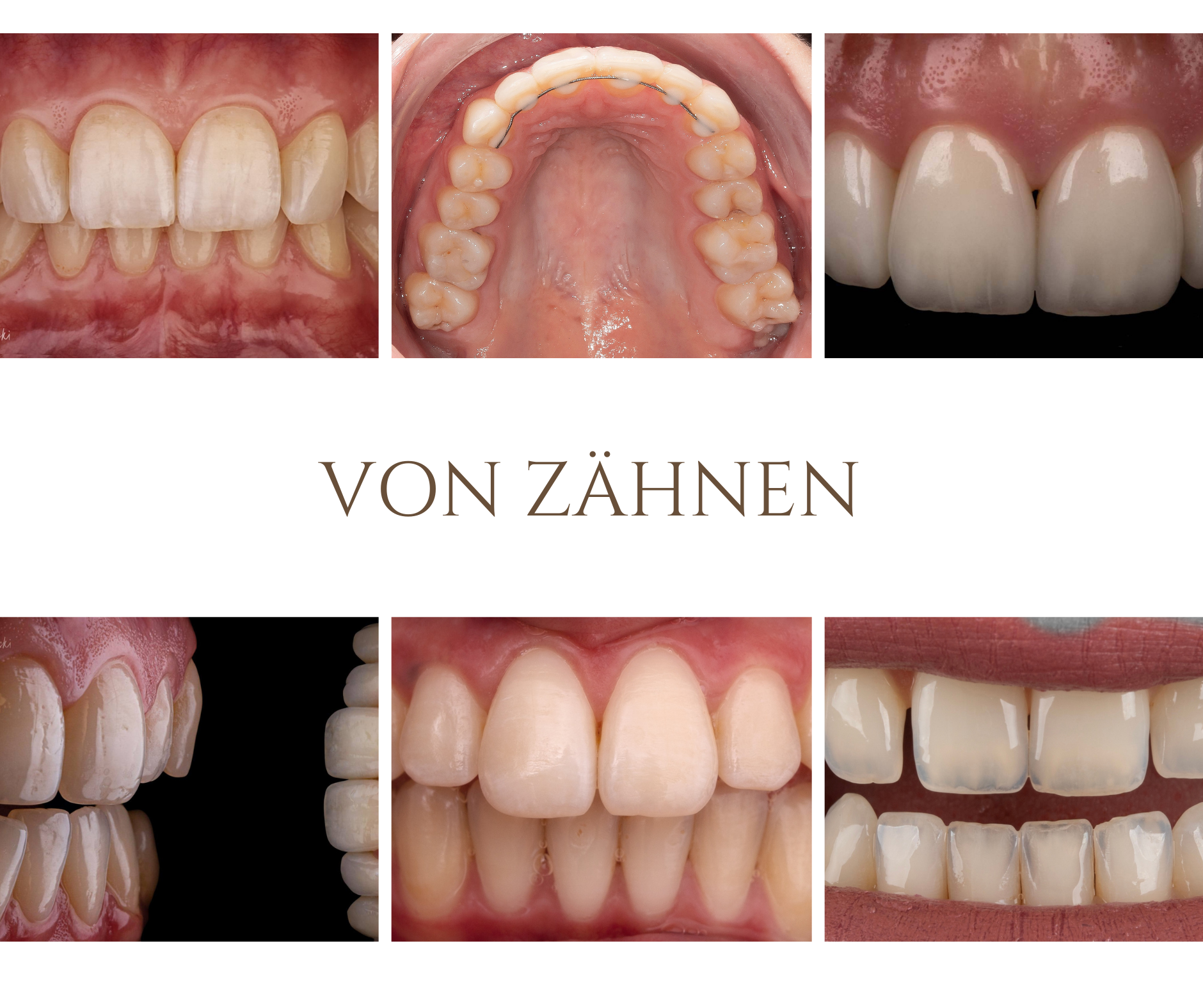 Einblicke in einen Dentalfotografie Workshop
