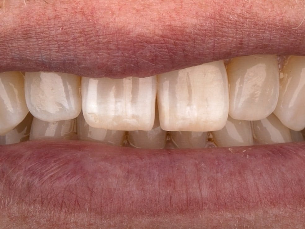 Welche Kamera ist die richtige für die Dentalfotografie?