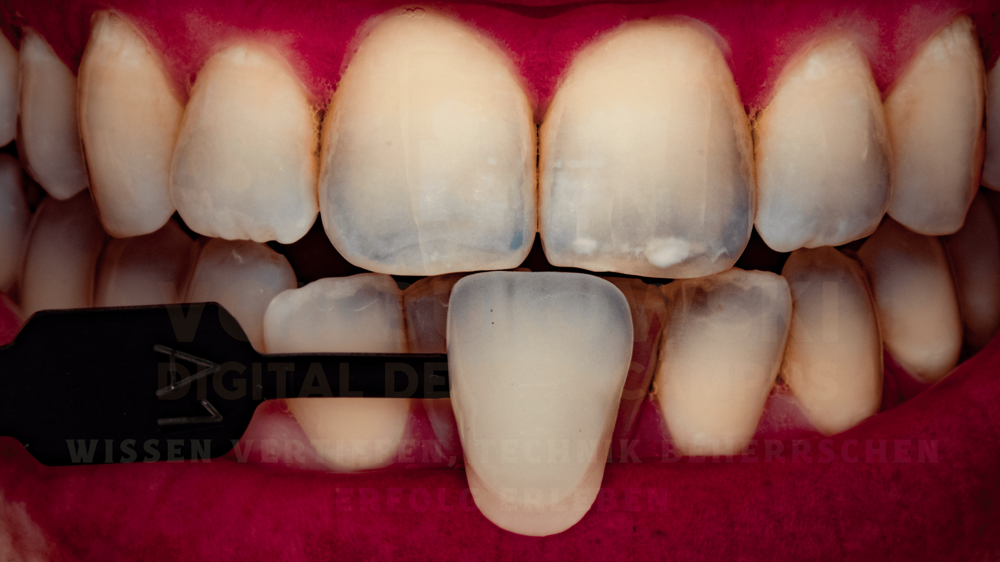 Welche Kamera ist die richtige für die Dentalfotografie?