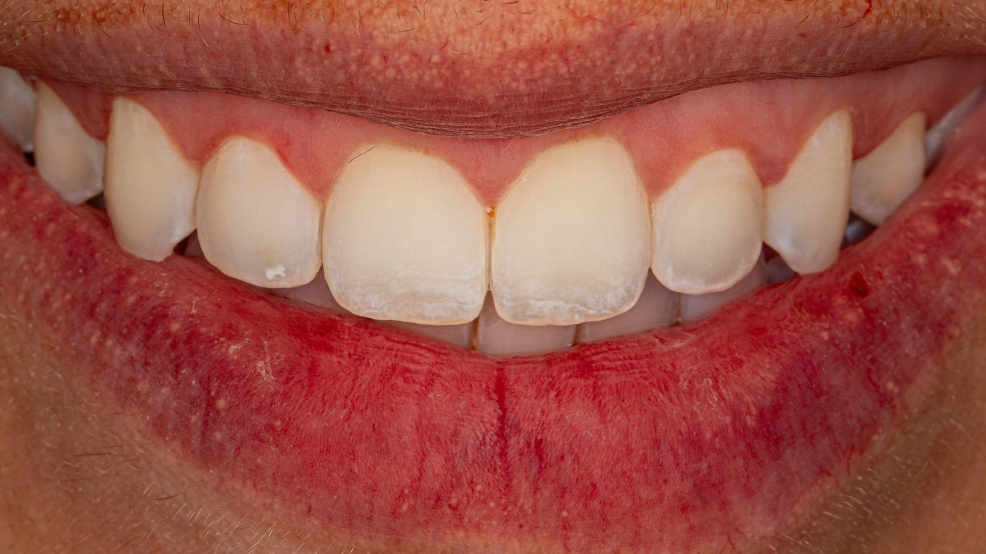 Der ultimative Leitfaden zum 16:9-Format in der Dentalfotografie: Professionelle Kameraeinstellungen für moderne Zahnarztpraxen