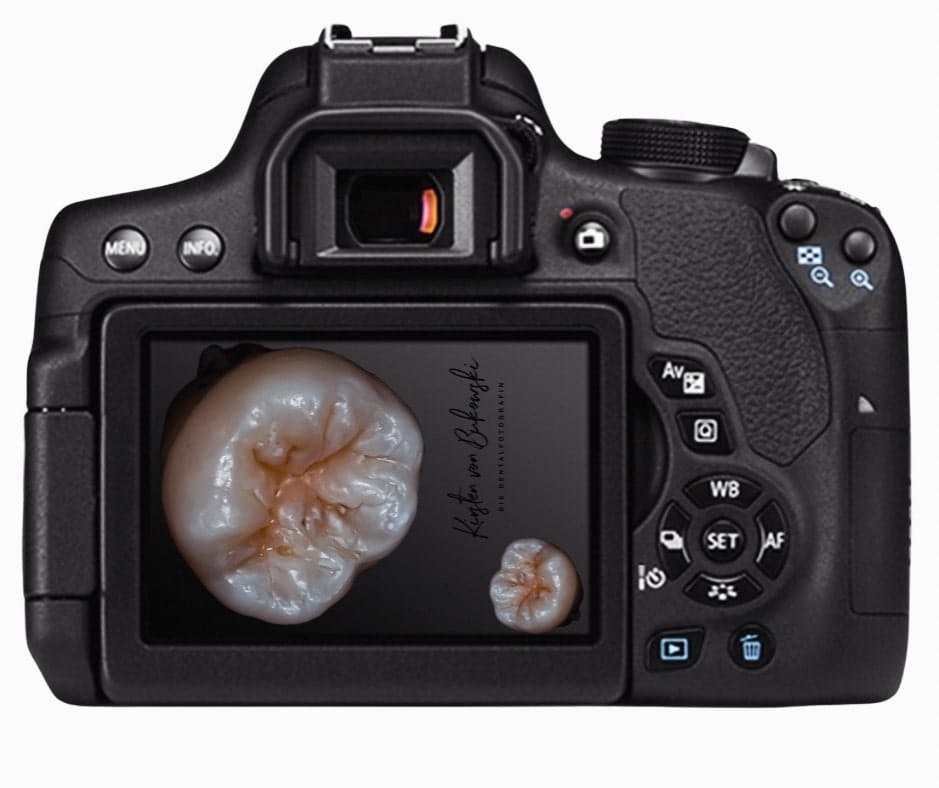 Welche Kamera ist die richtige für die Dentalfotografie?