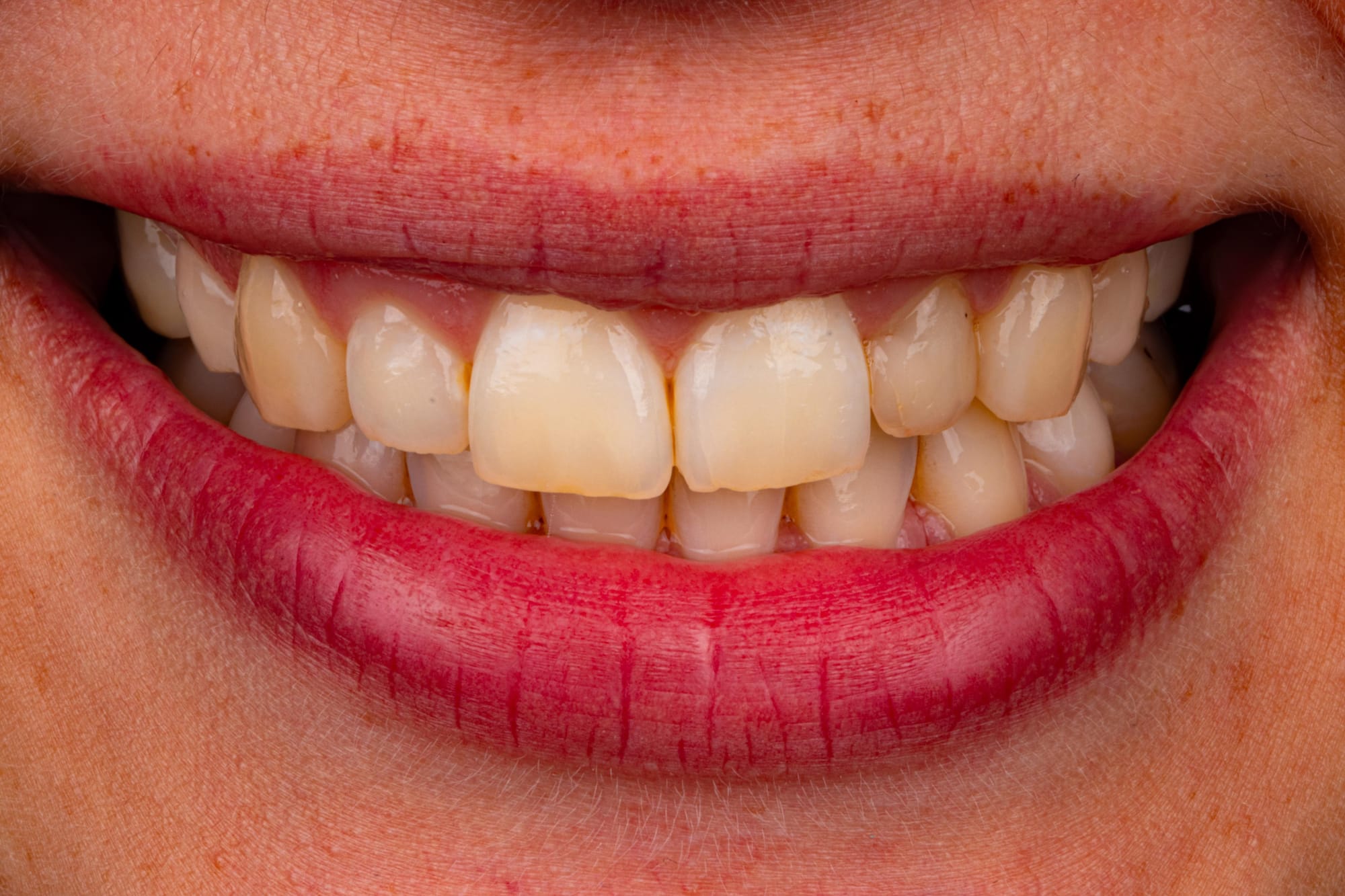 Welche Kamera ist die richtige für die Dentalfotografie?