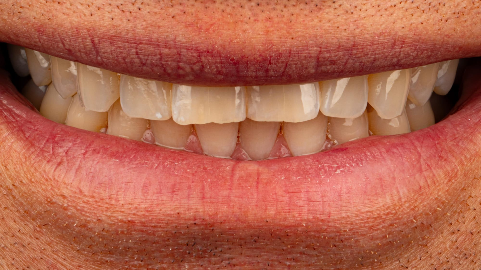 Welche Kamera ist die richtige für die Dentalfotografie?