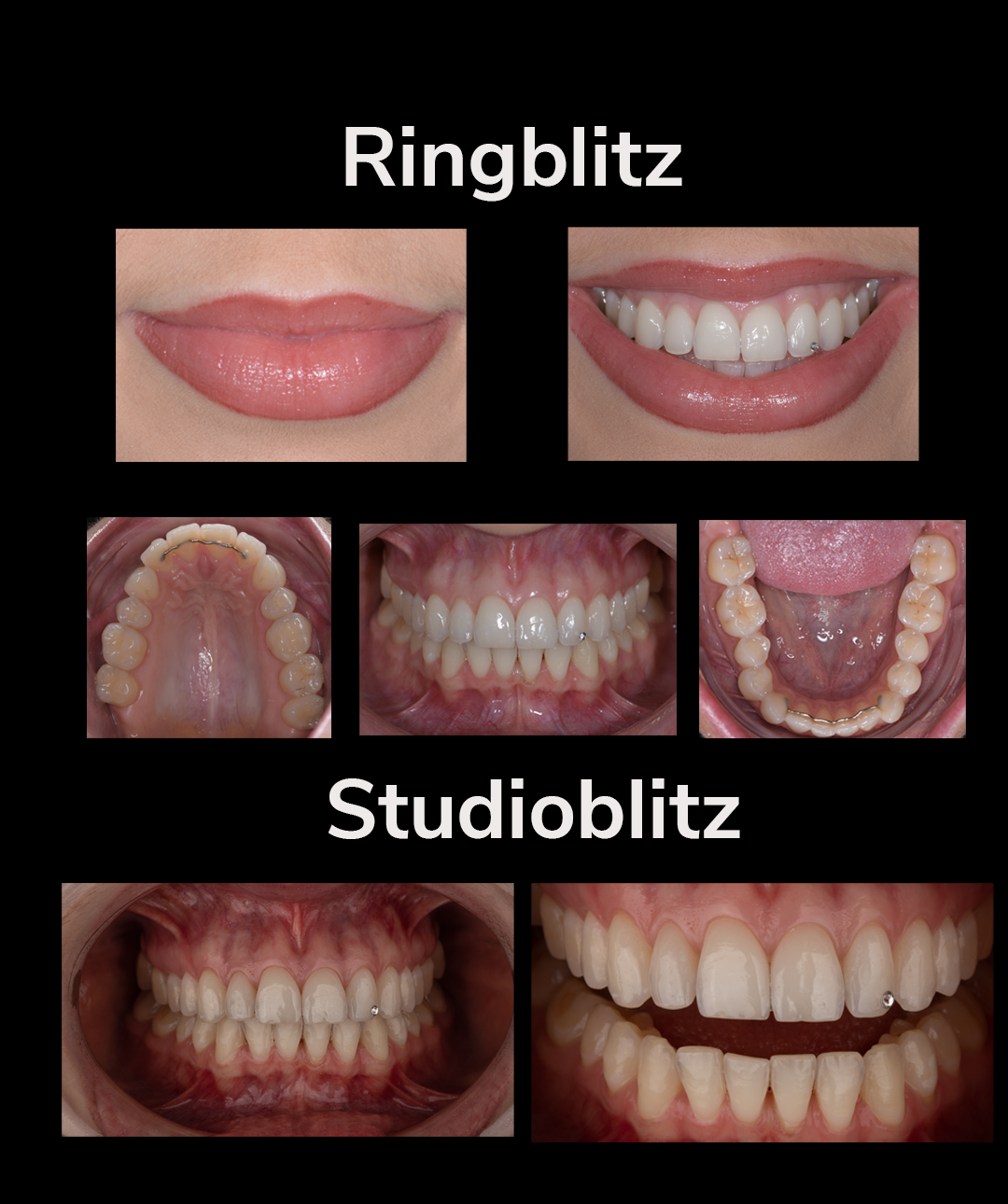 Welche Kamera ist die richtige für die Dentalfotografie?