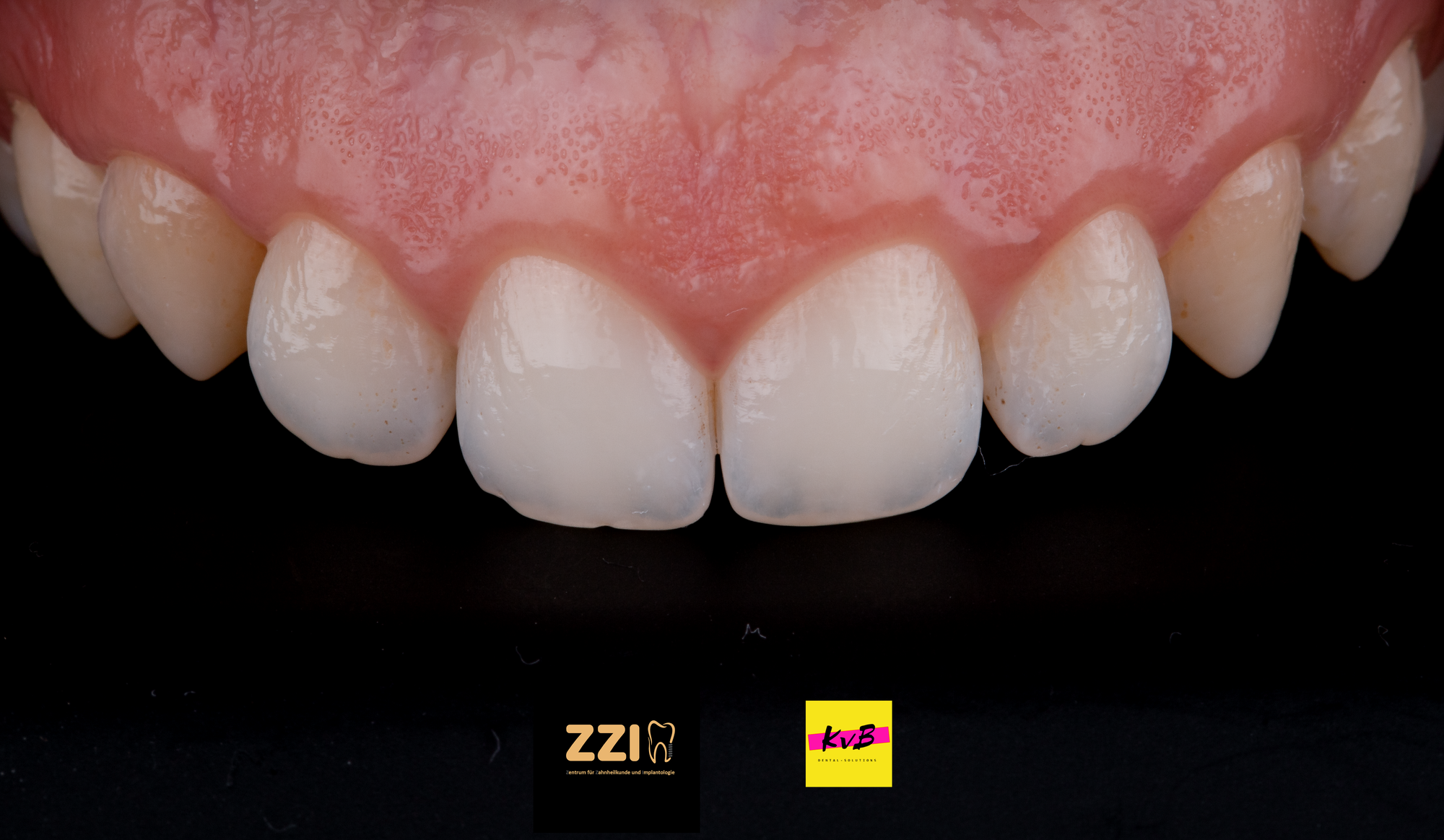 Welche Kamera ist die richtige für die Dentalfotografie?