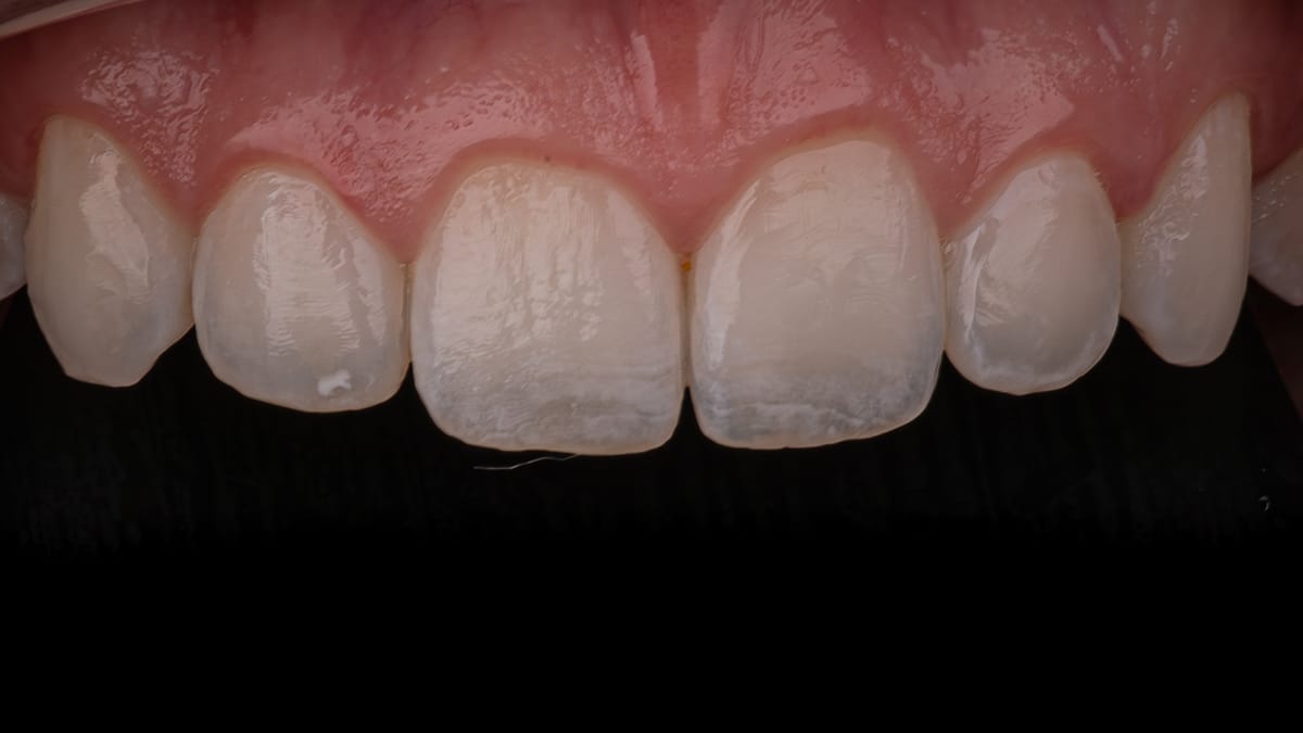 Der ultimative Leitfaden zum 16:9-Format in der Dentalfotografie: Professionelle Kameraeinstellungen für moderne Zahnarztpraxen