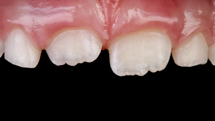 5 Große Fehler, die Zahnarztpraxen und Dentallabore 2025 machen – und wie du sie vermeidest