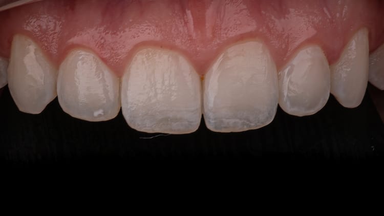 Der ultimative Leitfaden zum 16:9-Format in der Dentalfotografie: Professionelle Kameraeinstellungen für moderne Zahnarztpraxen
