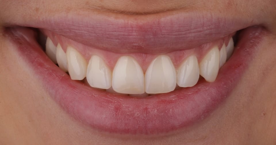 Dentalfotografie, Foto aus dem Dentalfotografieworkshop